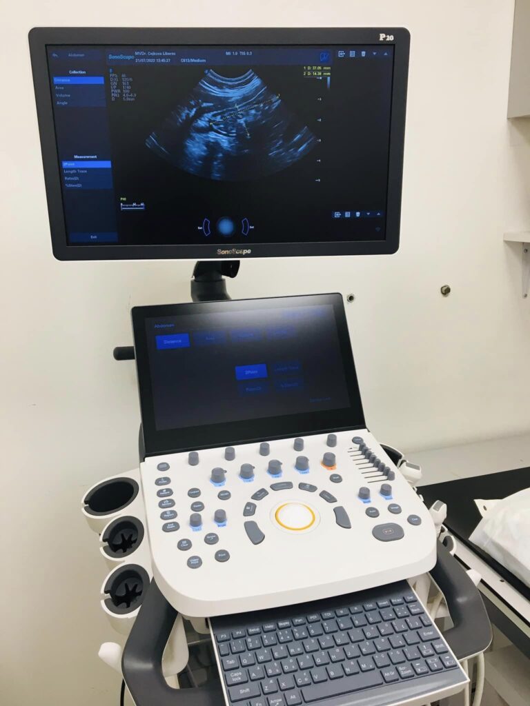 USG, ultrazvuk, sonograf